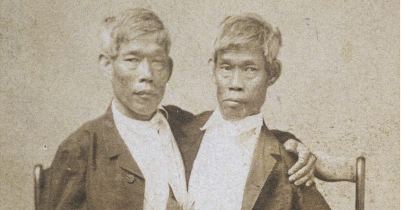 Who Were the Original Siamese Twins?