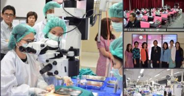 รพ.จุฬาลงกรณ์ จับมือทีมแพทย์ญี่ปุ่น ร่วมพัฒนาเทคโนโลยี และปลูกถ่ายสเต็มเซลล์รักษาโรคกระจกตา ได้สำเร็จ!