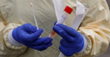 US slashes testing rules to speedup coronavirus screening