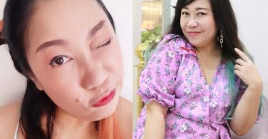 “ก้อย ศิรินุช” ศัลยกรรมยกเครื่องหน้า ถูกทักดูเด็กลง 10 ปี เปิดใจอยากทำส่วนอื่นเพิ่ม