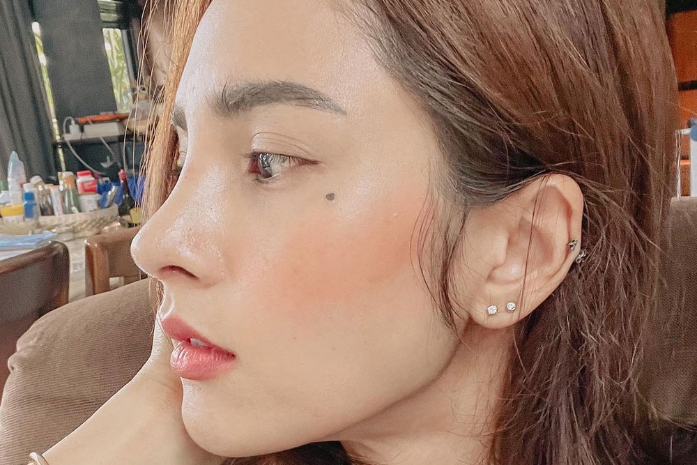 “อุ้ม ลักขณา” มุมด้านข้างของจมูกใหม่ พุ่งเป๊ะเป็นเคิร์ฟสวยงาม