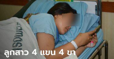ฮือฮา สาวนครพนมคลอดลูกสาวมี 4 แขน 4 ขา เบื้องต้นแข็งแรง แต่แพทย์ยังจับตาใกล้ชิด
