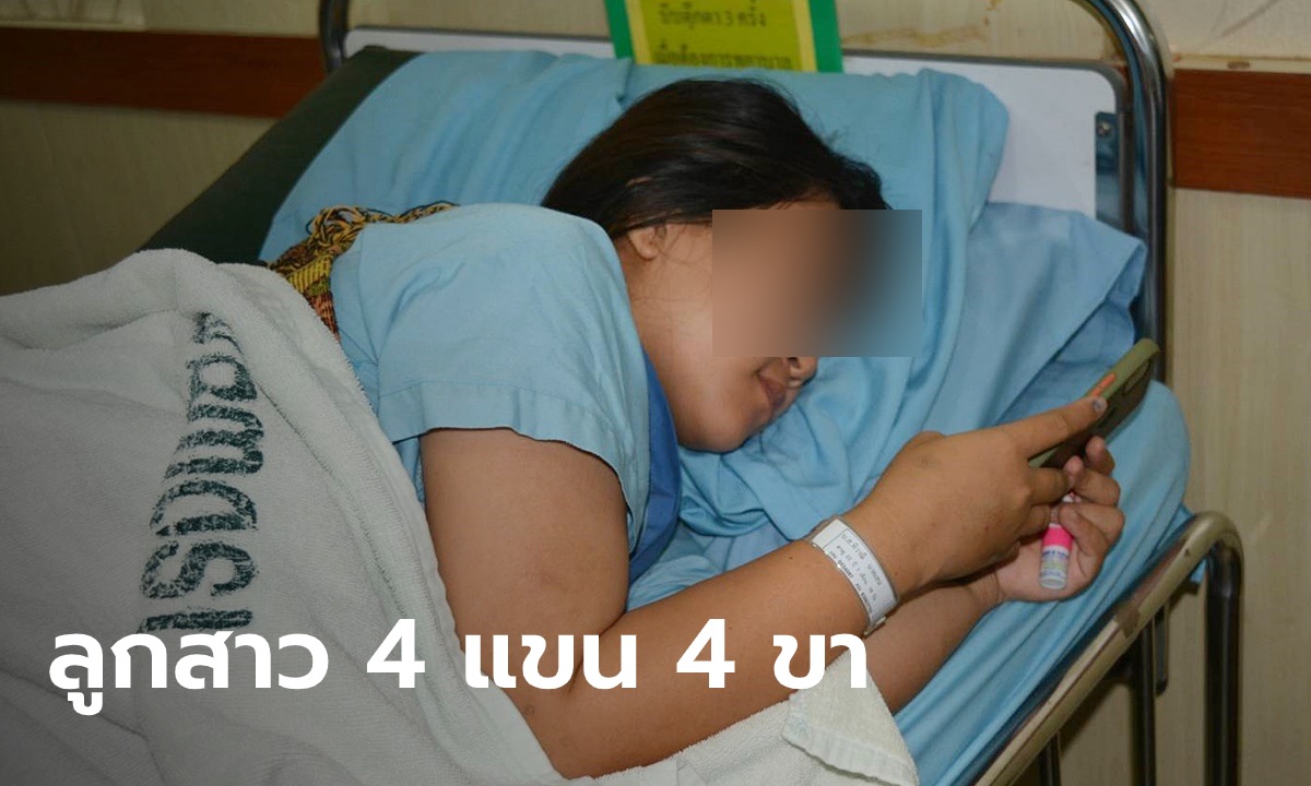 ฮือฮา สาวนครพนมคลอดลูกสาวมี 4 แขน 4 ขา เบื้องต้นแข็งแรง แต่แพทย์ยังจับตาใกล้ชิด