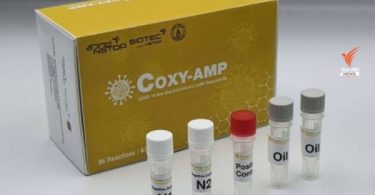 Thailand’s COVID rapid test kit in final 20 of in XPRIZE Foundation competition