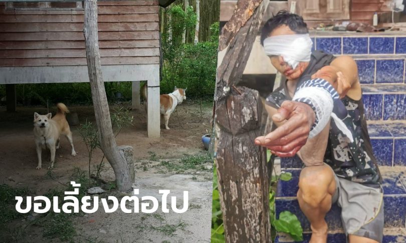 “หมาบางแก้ว” ตกใจเสียงฟ้าร้อง ขย้ำเจ้าของหวิดดับ แผลฉกรรจ์เย็บกว่า 100 เข็ม