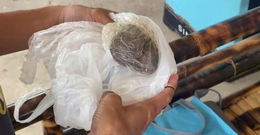 แม่ลูกอ่อนโพสต์เล่าประสบการณ์ช็อก หมอลืมผ้าก๊อซในช่องคลอดนาน 2 เดือน