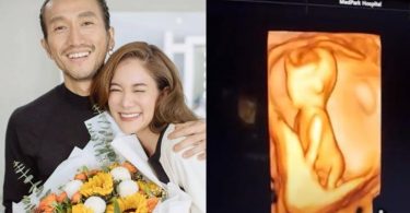 “ก้อย-ตูน” เฉลย 1+1 = 3 ท้องลูกคนแรกแล้ว แฟนๆ แห่ยินดีล้นหลาม