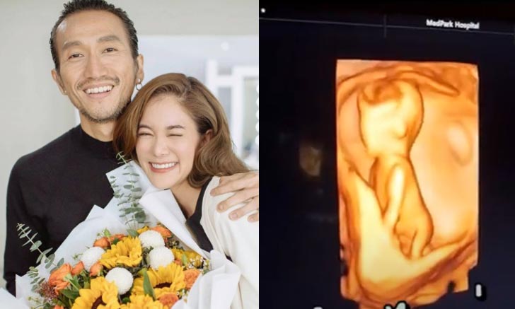 “ก้อย-ตูน” เฉลย 1+1 = 3 ท้องลูกคนแรกแล้ว แฟนๆ แห่ยินดีล้นหลาม