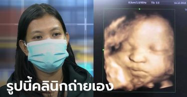 “ท้องทิพย์” โป๊ะต่อ! คลินิกฝากครรภ์แหกเอง อยากได้ภาพอัลตราซาวด์ชัดๆ มาที่นี่ ไม่ต้องกูเกิล