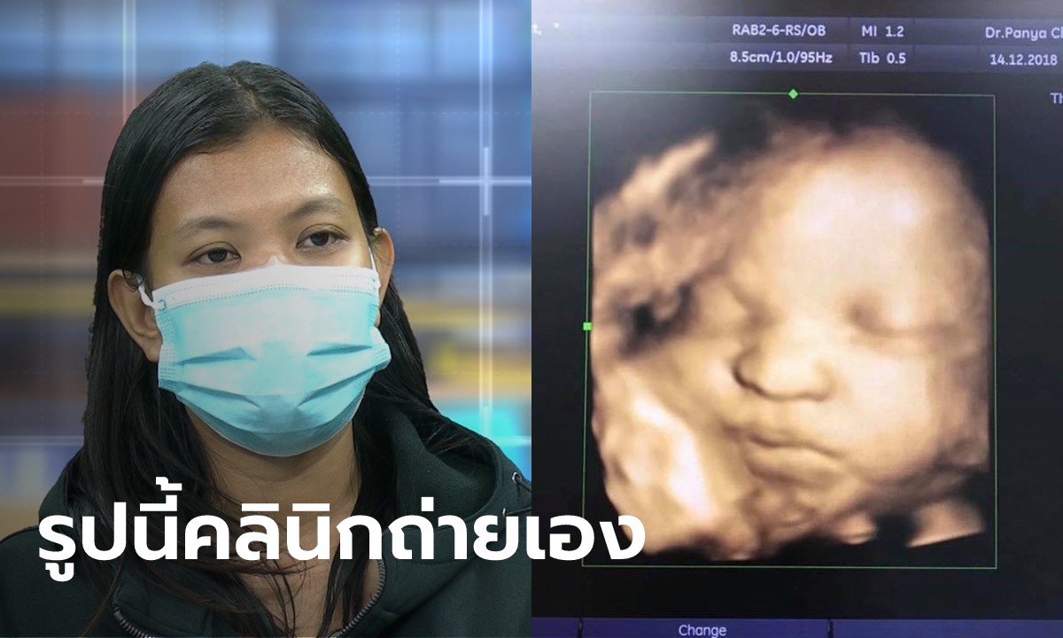 “ท้องทิพย์” โป๊ะต่อ! คลินิกฝากครรภ์แหกเอง อยากได้ภาพอัลตราซาวด์ชัดๆ มาที่นี่ ไม่ต้องกูเกิล
