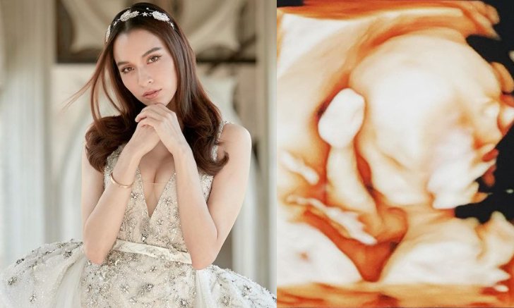 “หยาดทิพย์” เฉลยเพศลูกคนแรกแล้ว สุดตื่นเต้น อีก 3 เดือนจะได้เจอเบบี๋